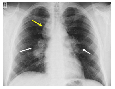 Enunciado 4681988-1