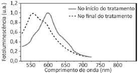 Alternativa 1-1